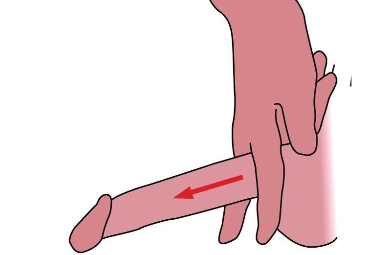 technika protahování penisu